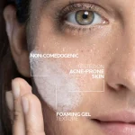 La Roche-Posay Effaclar + M Purifying Foaming Gel Cleanser | 400mL - Image 4