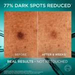 L'Oréal Paris Bright Reveal 10% [Niacinamide + Melasyl + Amino-Sulfonic Acid] Dark Spot Serum | 30mL - Image 4
