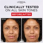 LOreal Paris Revitalift Filler Plumping Water Cream with Hyaluronic Acid | 50mL - Image 3