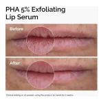 The Ordinary PHA 5% Exfoliating Lip Serum | 15mL - Image 2
